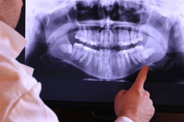 Best Emergency Broken Tooth Repair in Emmitsburg, MD