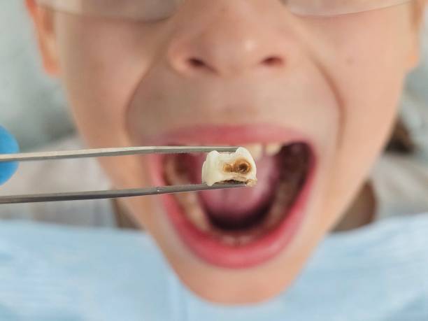 Best Pediatric Emergency Dentist in Emmitsburg, MD